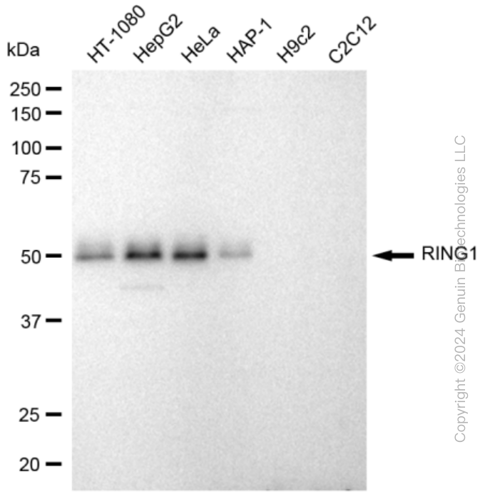 KD-Validated Anti-RING1 Rabbit Monoclonal Antibody ABG2358