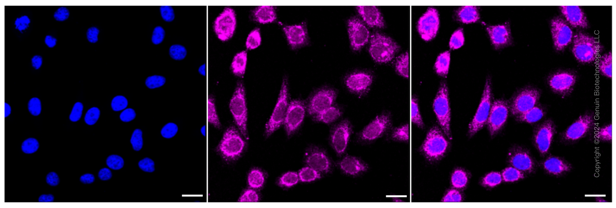 KD-Validated Anti-Brain derived neurotrophic factor Rabbit Monoclonal Antibody ABG2360