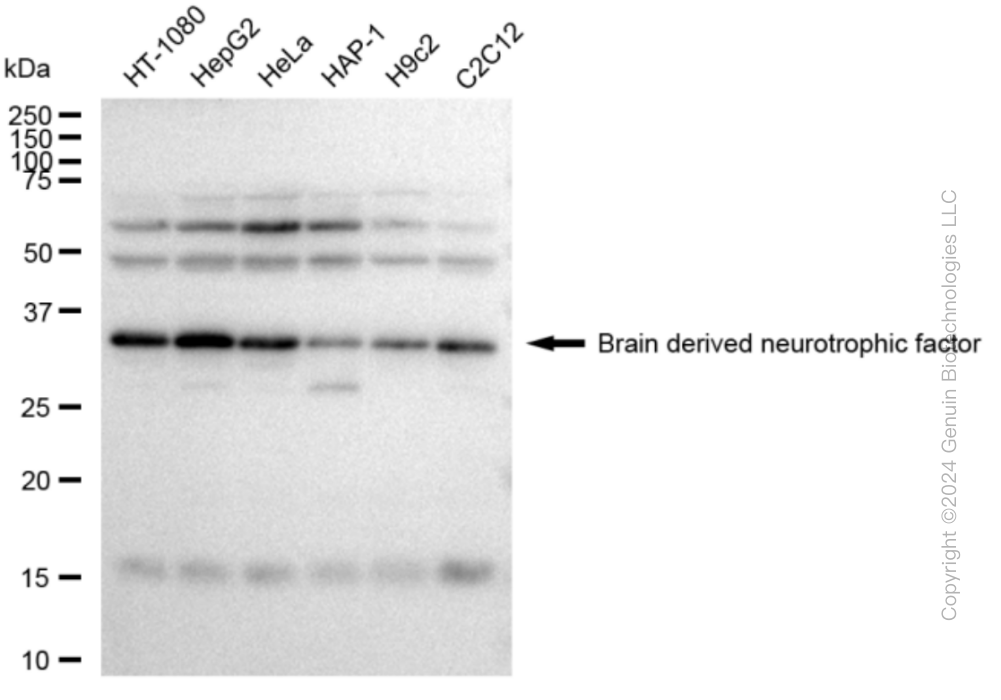 KD-Validated Anti-Brain derived neurotrophic factor Rabbit Monoclonal Antibody ABG2360