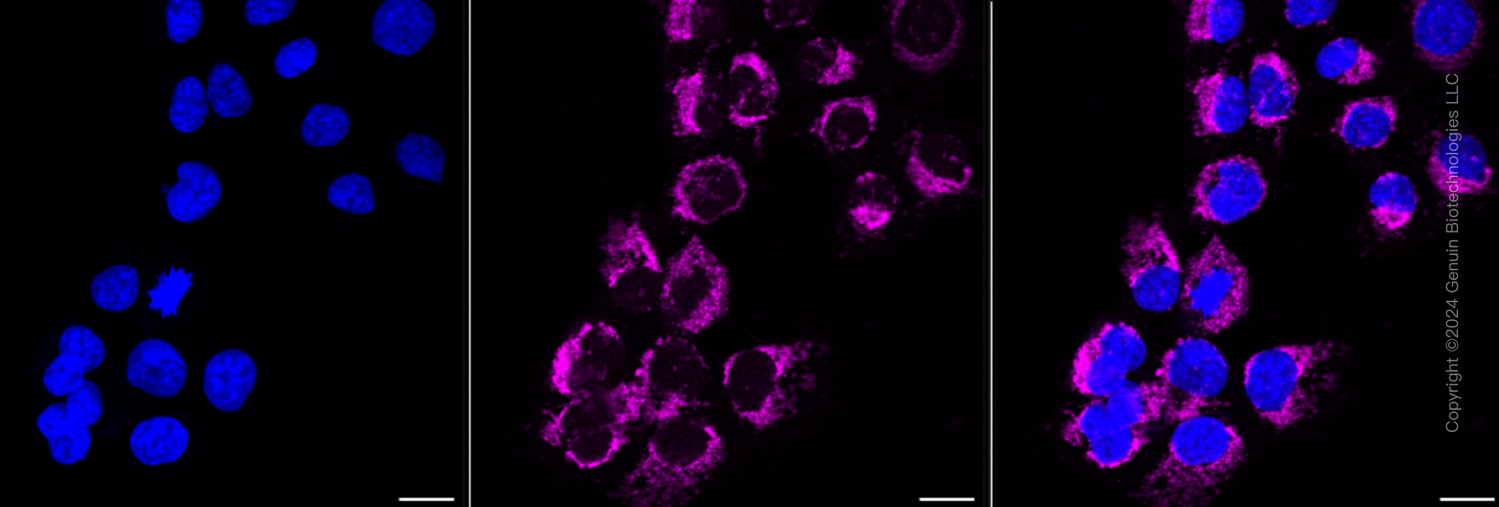 KD-Validated Anti-Hexokinase 1 Rabbit Monoclonal Antibody ABG2361