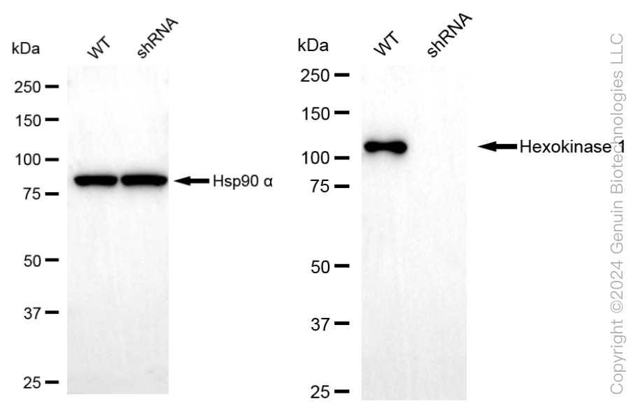 KD-Validated Anti-Hexokinase 1 Rabbit Monoclonal Antibody ABG2361