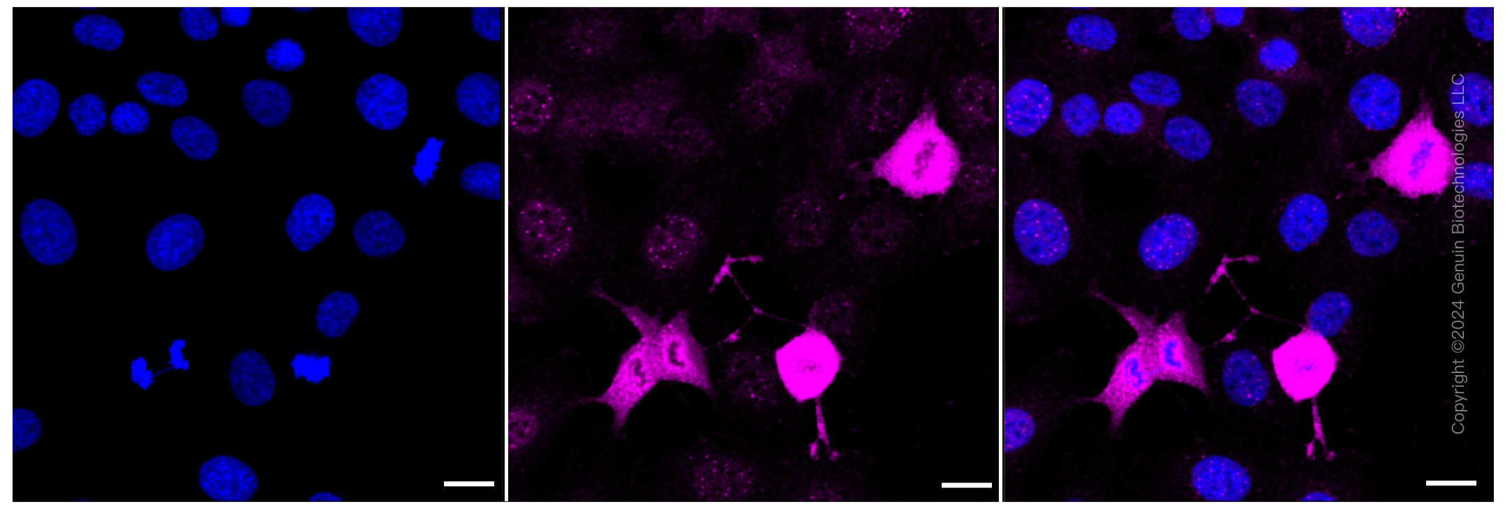 KD-Validated Anti-Phospho-PKC alpha (Ser657) Rabbit Monoclonal Antibody ABG2362