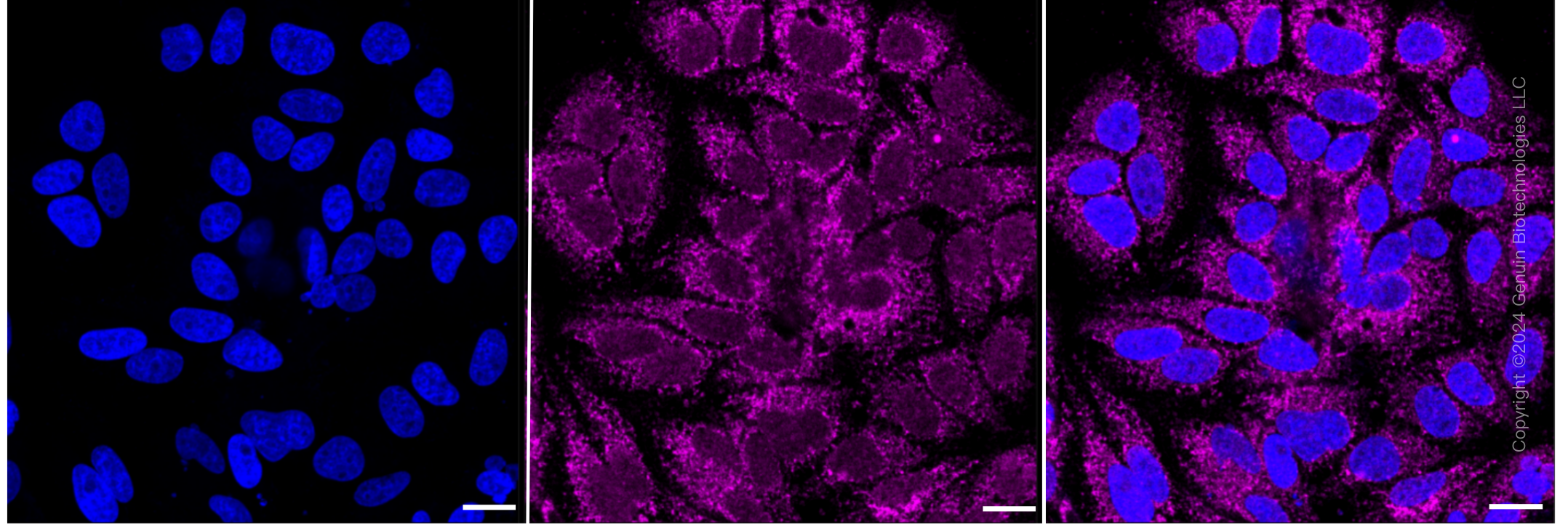 KD-Validated Anti-DLAT Rabbit Monoclonal Antibody ABG2363