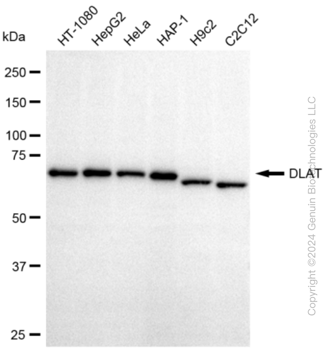 KD-Validated Anti-DLAT Rabbit Monoclonal Antibody ABG2363