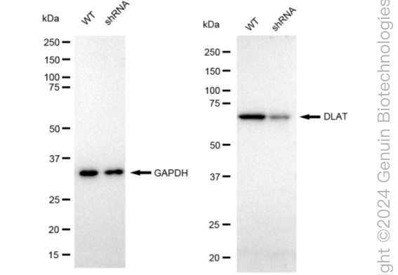 KD-Validated Anti-DLAT Rabbit Monoclonal Antibody ABG2363