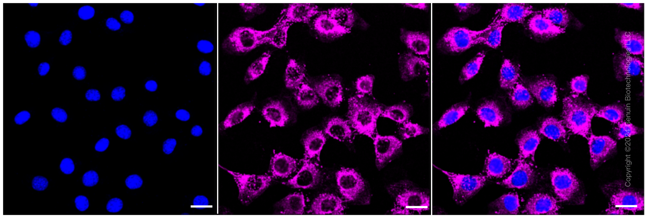 KD-Validated Anti-Fibronectin 1 Rabbit Monoclonal Antibody ABG2367