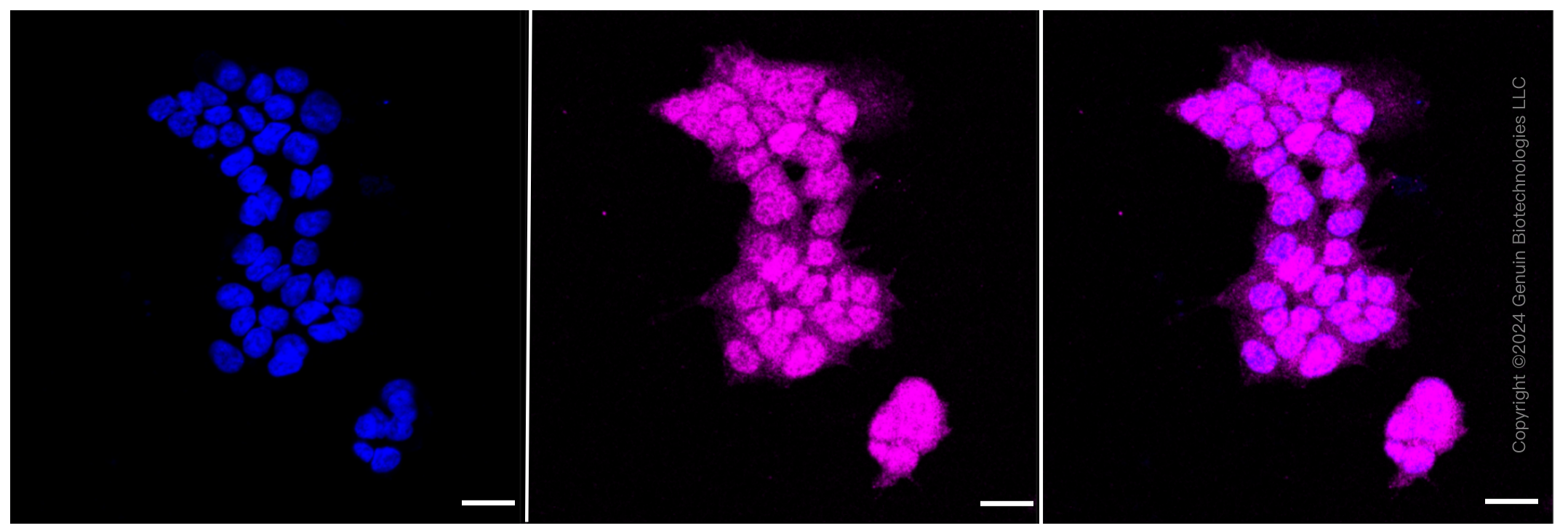 KD-Validated Anti-Smad2 Rabbit Monoclonal Antibody ABG2368