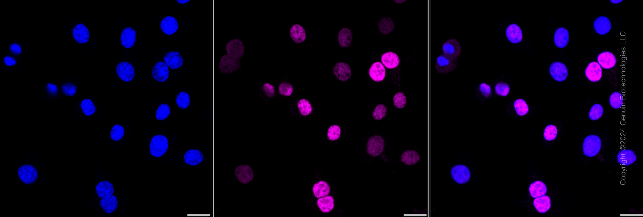 KD-Validated Anti-Cyclin D1 Rabbit Monoclonal Antibody ABG2370