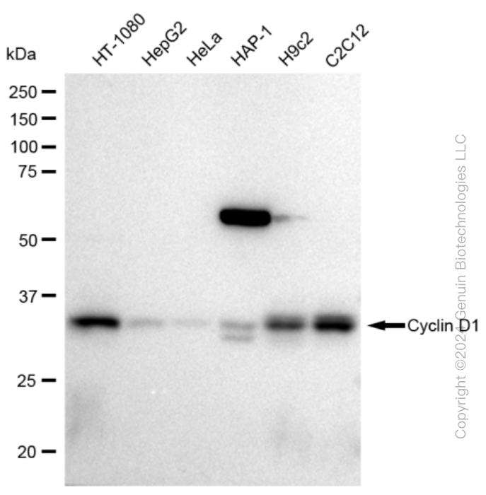 KD-Validated Anti-Cyclin D1 Rabbit Monoclonal Antibody ABG2370