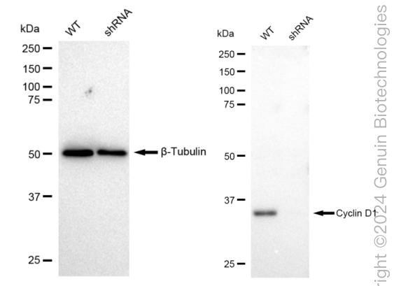 KD-Validated Anti-Cyclin D1 Rabbit Monoclonal Antibody ABG2370
