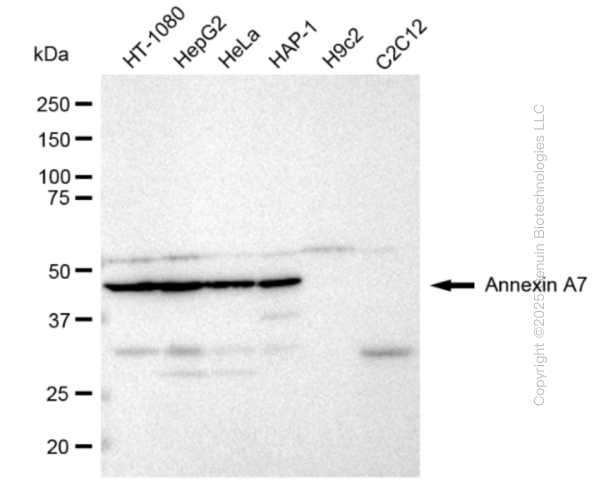 KD-Validated Anti-Annexin A7 Rabbit Monoclonal Antibody ABG2371