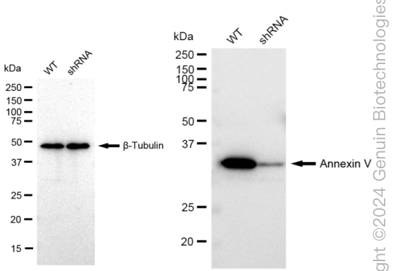 KD-Validated Anti-Annexin V Rabbit Monoclonal Antibody ABG2372