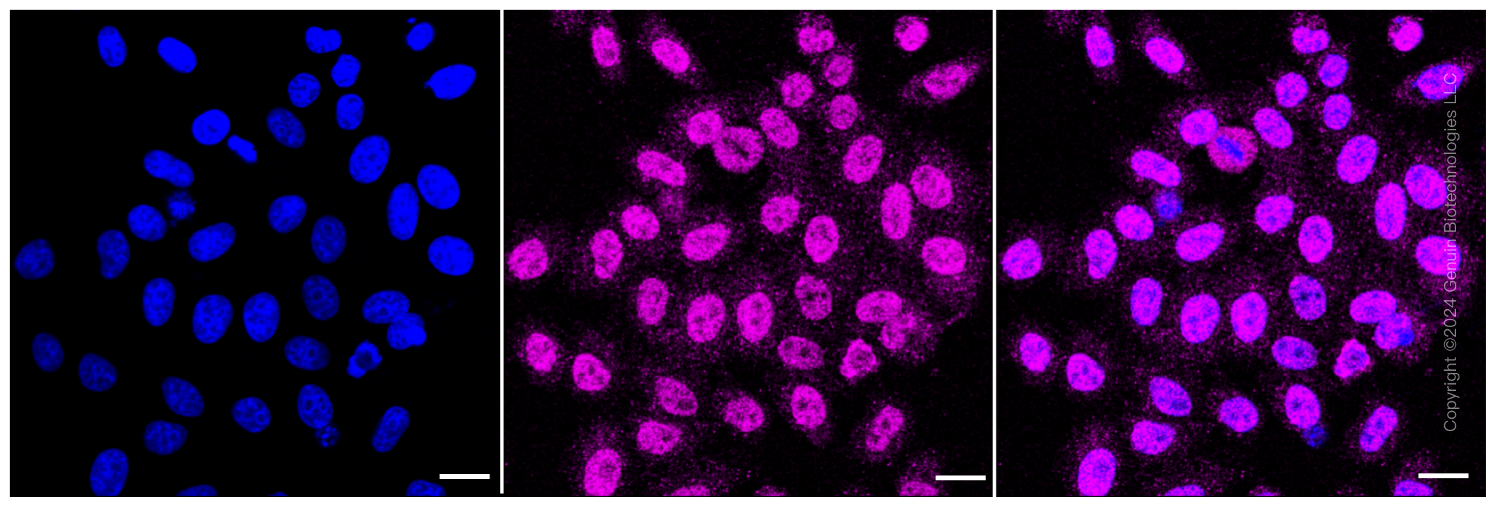 KD-Validated Anti-ERCC1 Rabbit Monoclonal Antibody ABG2374