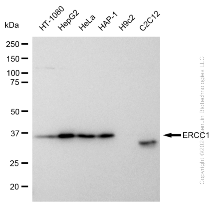 KD-Validated Anti-ERCC1 Rabbit Monoclonal Antibody ABG2374