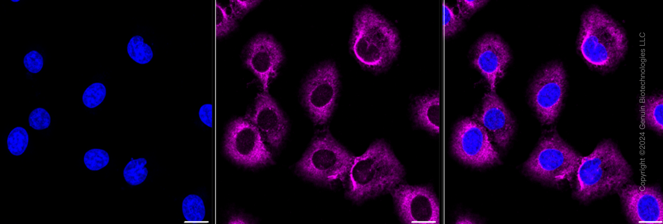 KD-Validated Anti-Arg2 Rabbit Monoclonal Antibody ABG2376