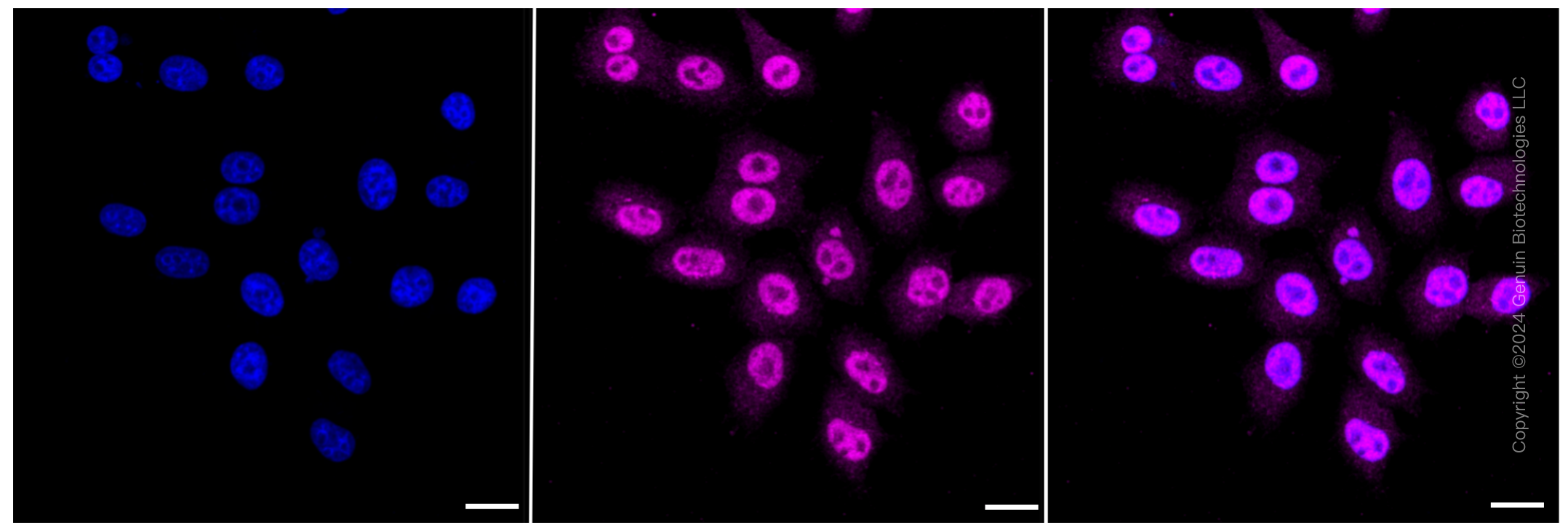 KD-Validated Anti-CRKII Rabbit Monoclonal Antibody ABG2377