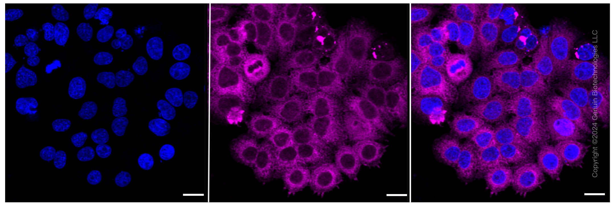 KD-Validated Anti-RRM1 Rabbit Monoclonal Antibody ABG2379