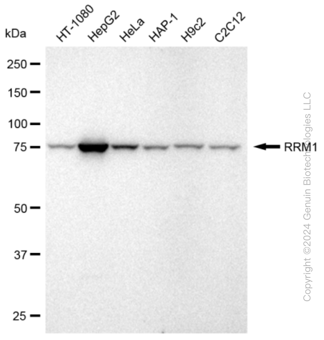 KD-Validated Anti-RRM1 Rabbit Monoclonal Antibody ABG2379