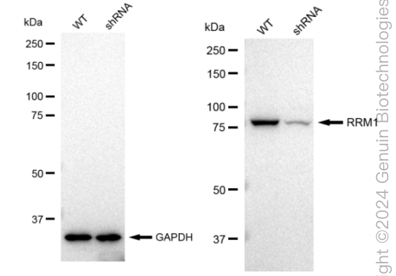 KD-Validated Anti-RRM1 Rabbit Monoclonal Antibody ABG2379