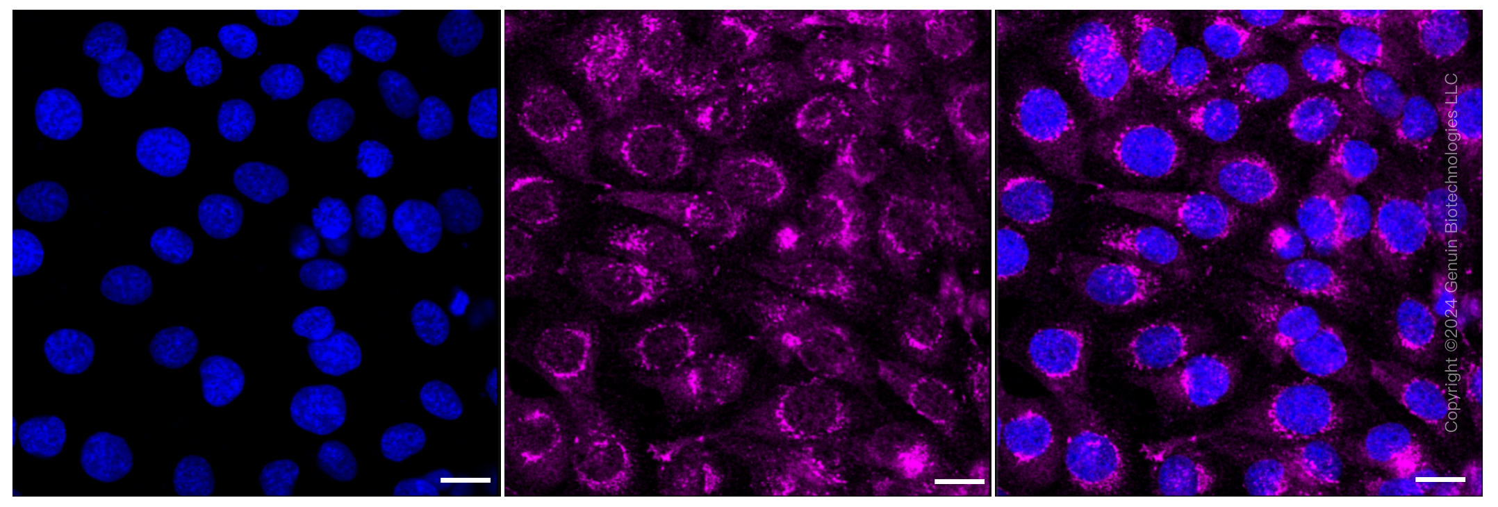 KD-Validated Anti-Amyloid beta precursor protein Rabbit Monoclonal Antibody ABG2381