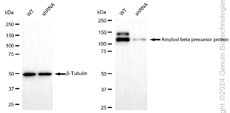 KD-Validated Anti-Amyloid beta precursor protein Rabbit Monoclonal Antibody ABG2381