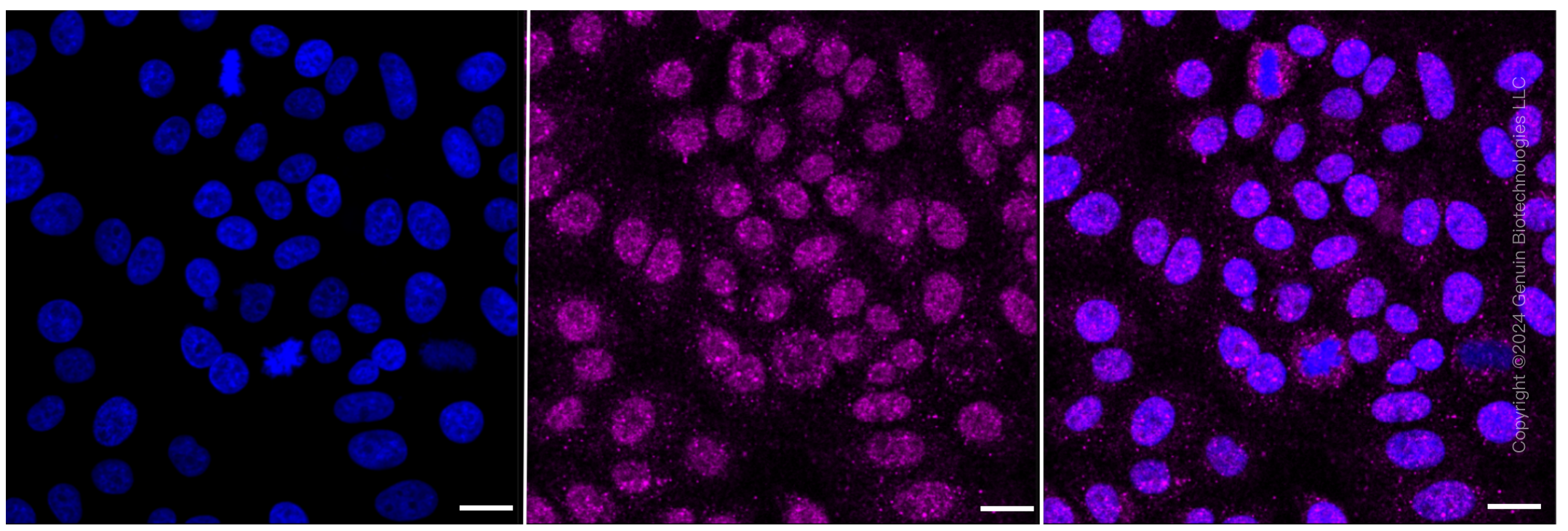 KD-Validated Anti-Arrestin beta 1 Rabbit Monoclonal Antibody ABG2382