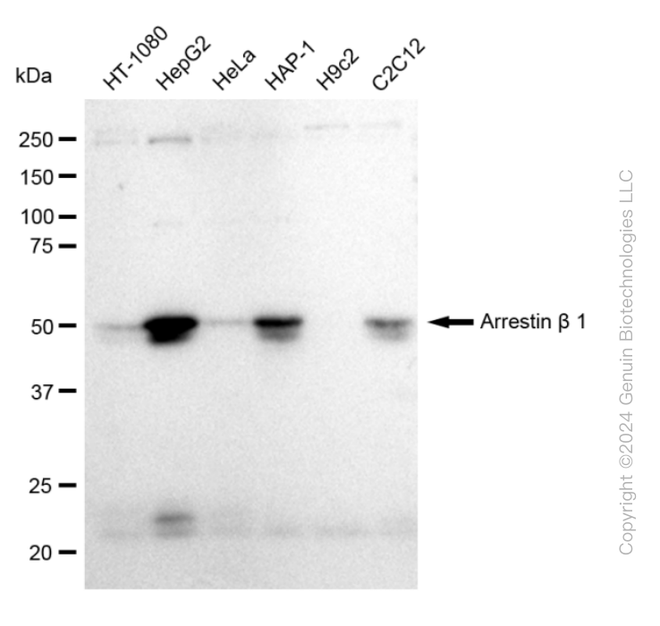 KD-Validated Anti-Arrestin beta 1 Rabbit Monoclonal Antibody ABG2382