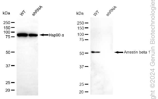 KD-Validated Anti-Arrestin beta 1 Rabbit Monoclonal Antibody ABG2382