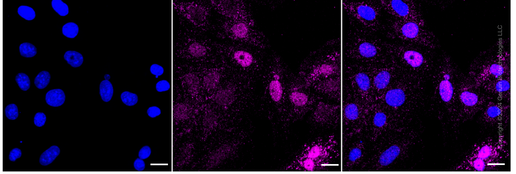 KD-Validated Anti-TFE3 Rabbit Monoclonal Antibody ABG2386