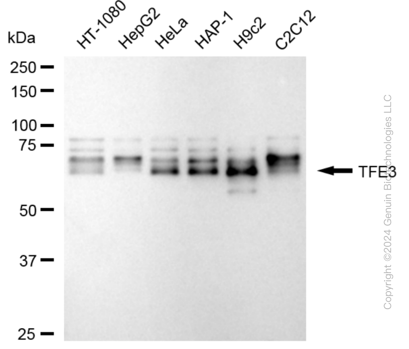 KD-Validated Anti-TFE3 Rabbit Monoclonal Antibody ABG2386
