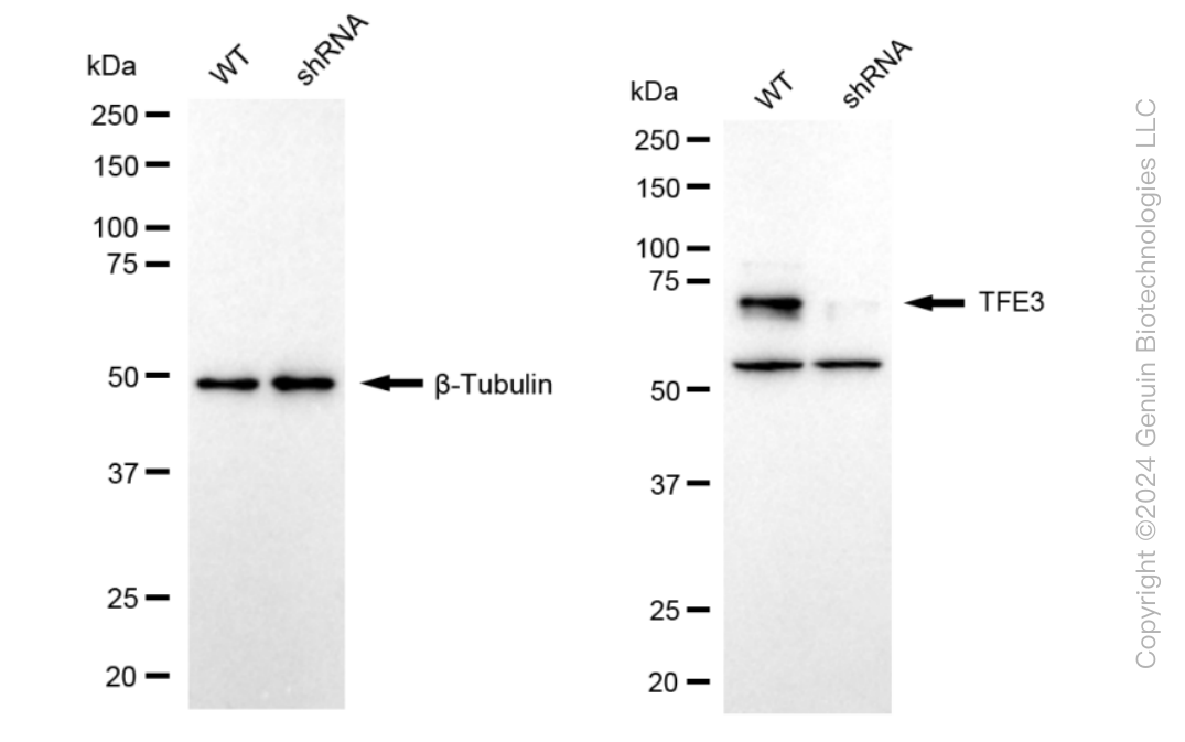 KD-Validated Anti-TFE3 Rabbit Monoclonal Antibody ABG2386