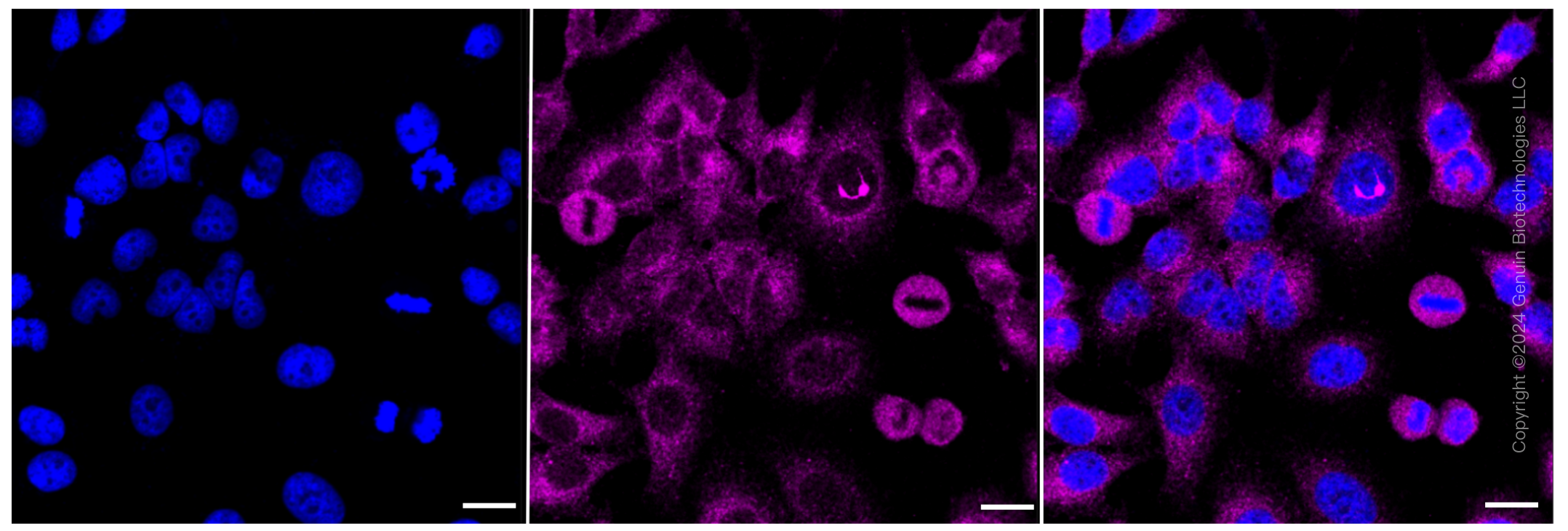 KD-Validated Anti-Tuberin Rabbit Monoclonal Antibody ABG2388