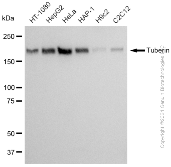 KD-Validated Anti-Tuberin Rabbit Monoclonal Antibody ABG2388