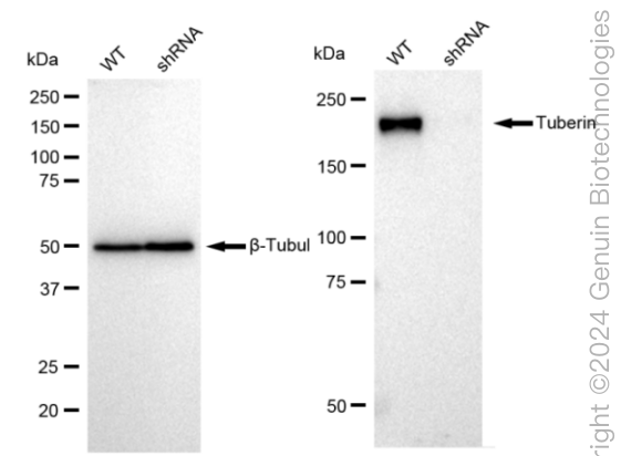 KD-Validated Anti-Tuberin Rabbit Monoclonal Antibody ABG2388
