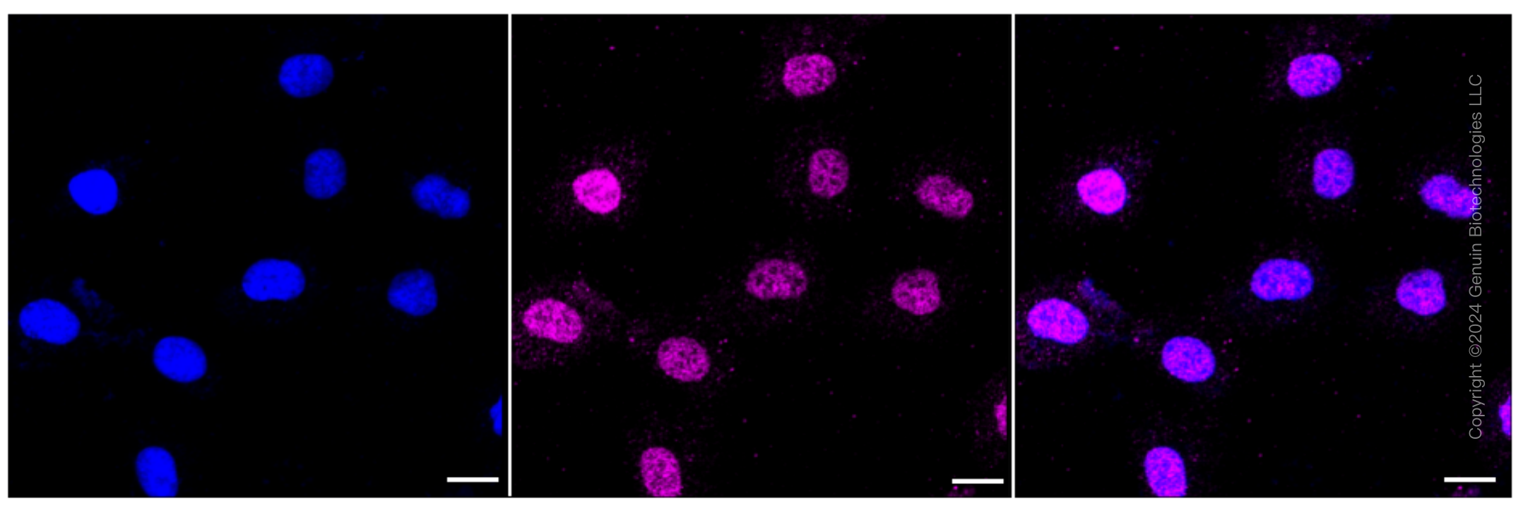 KD-Validated Anti-STAT6 Rabbit Monoclonal Antibody ABG2390