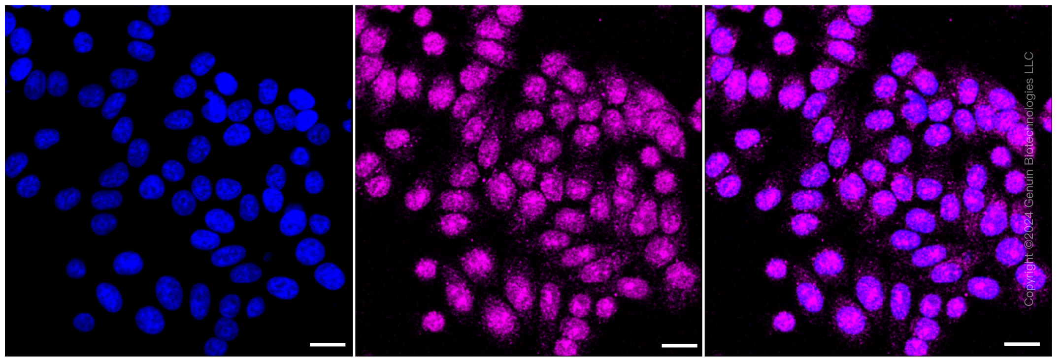 KD-Validated Anti-CD147 Rabbit Monoclonal Antibody ABG2391