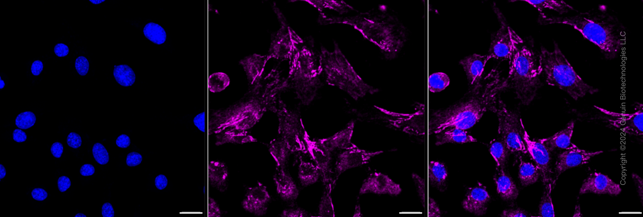 KD-Validated Anti-Integrin alpha 5 Rabbit Monoclonal Antibody ABG2392