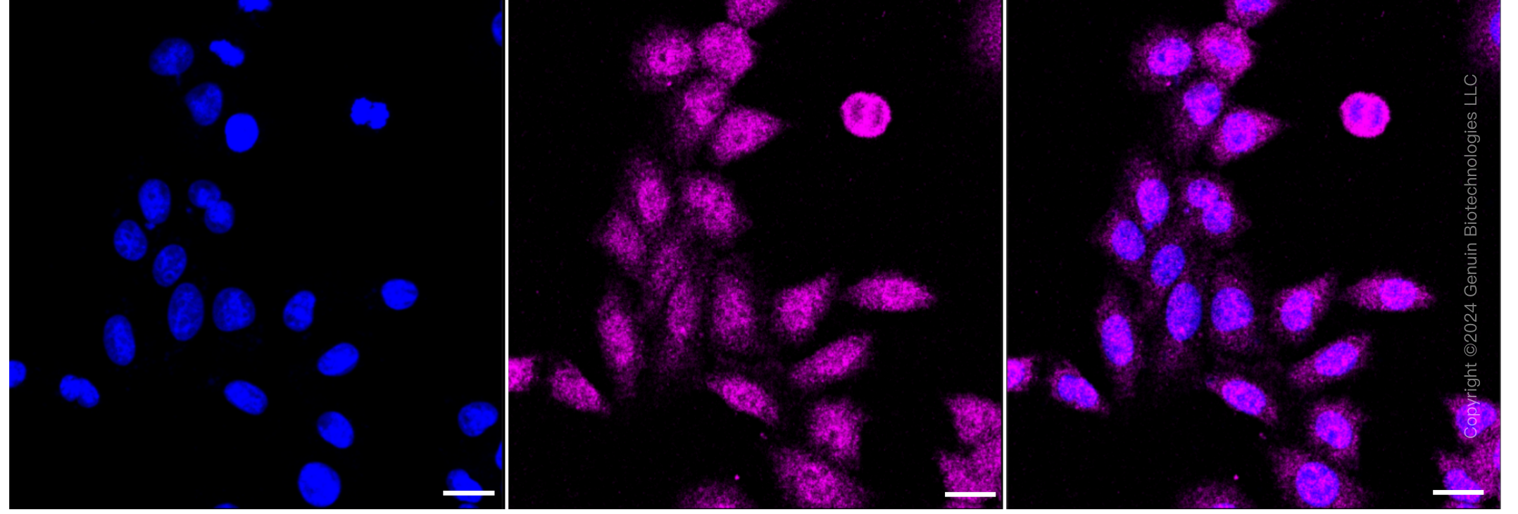 KD-Validated Anti-NUMB Rabbit Monoclonal Antibody ABG2396