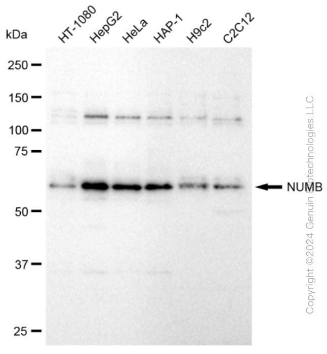 KD-Validated Anti-NUMB Rabbit Monoclonal Antibody ABG2396