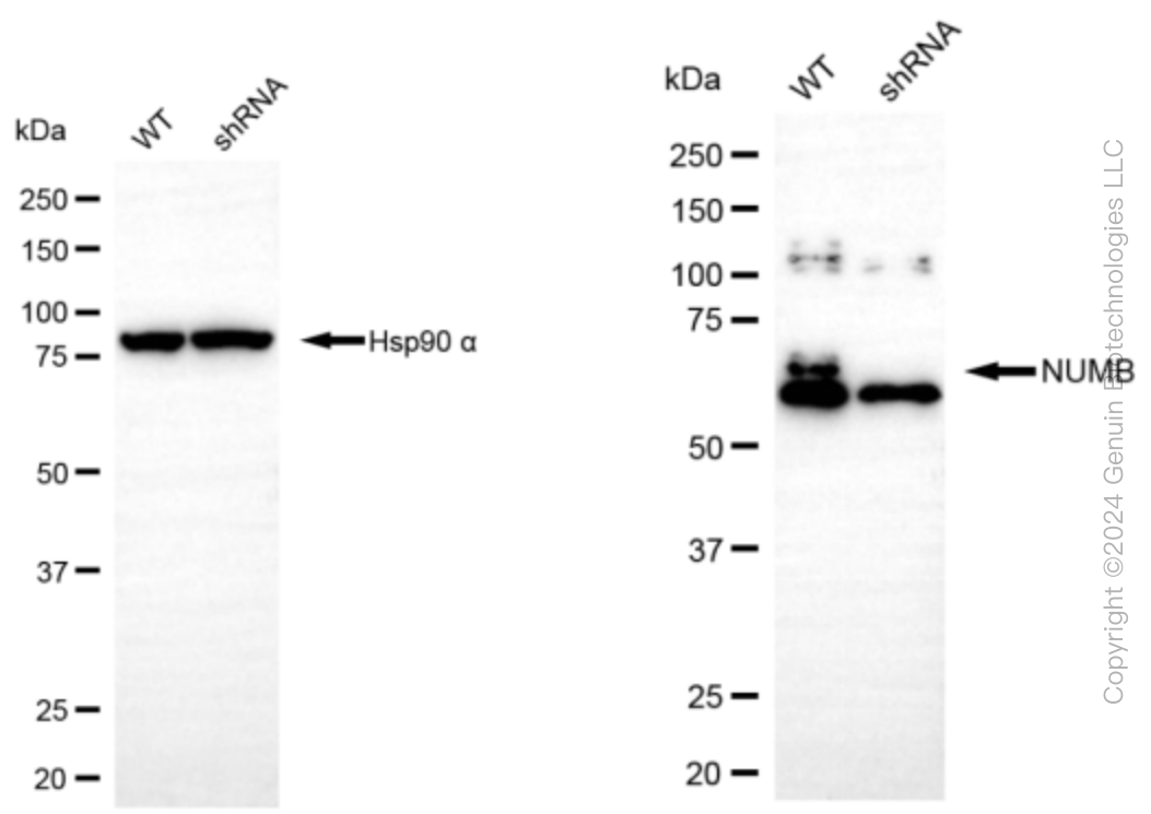KD-Validated Anti-NUMB Rabbit Monoclonal Antibody ABG2396