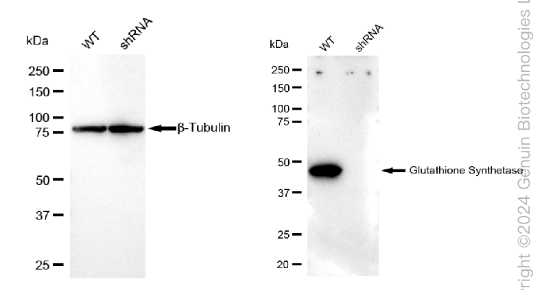 KD-Validated Anti-Glutathione synthetase Rabbit Monoclonal Antibody ABG2397