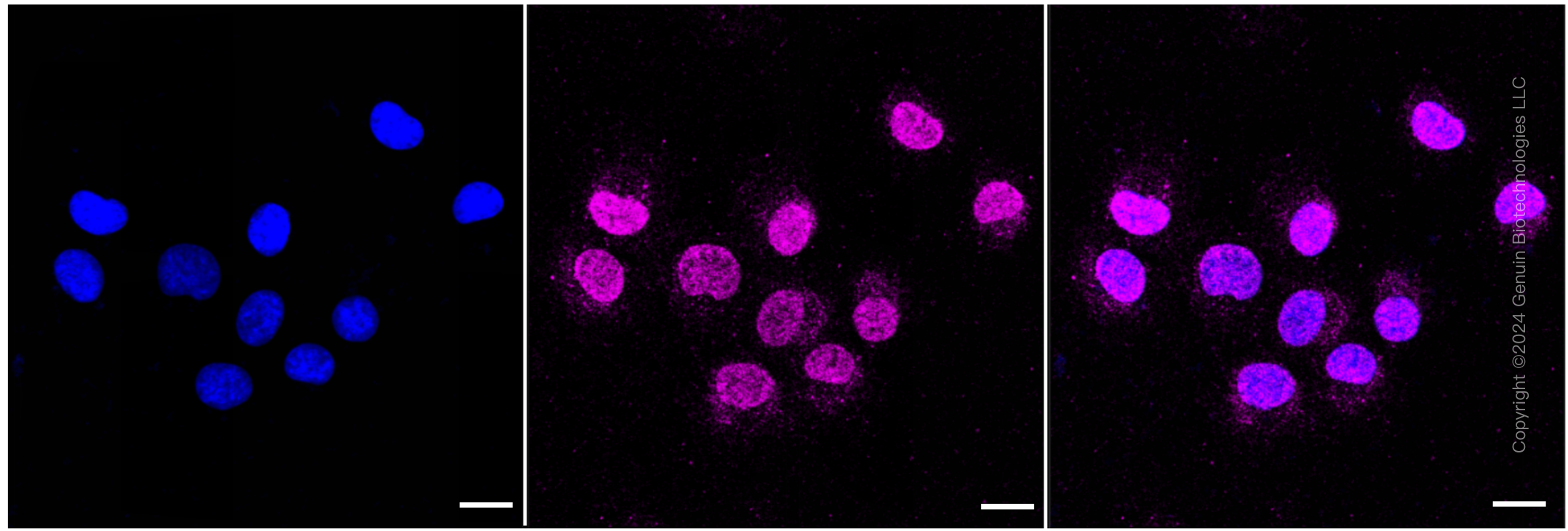 KD-Validated Anti-Cathepsin B Rabbit Monoclonal Antibody ABG2398