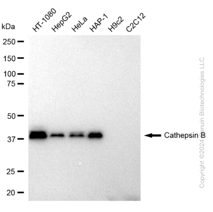 KD-Validated Anti-Cathepsin B Rabbit Monoclonal Antibody ABG2398