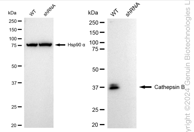 KD-Validated Anti-Cathepsin B Rabbit Monoclonal Antibody ABG2398