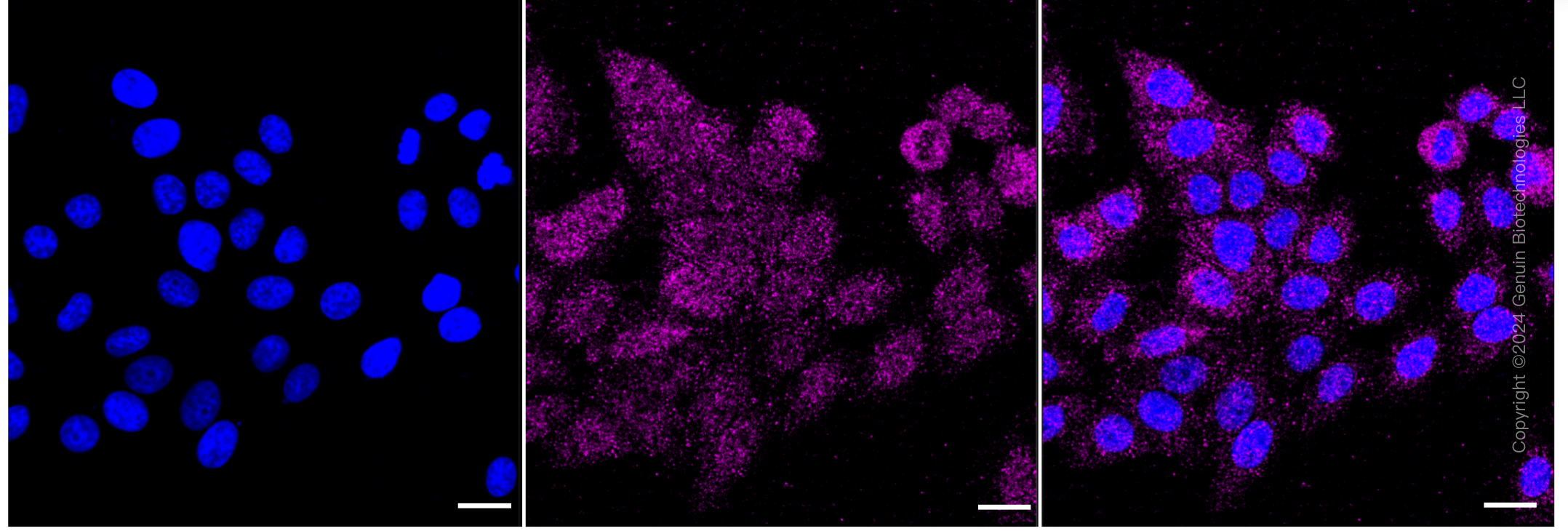 KD-Validated Anti-KMT6/EZH2 Rabbit Monoclonal Antibody ABG2399