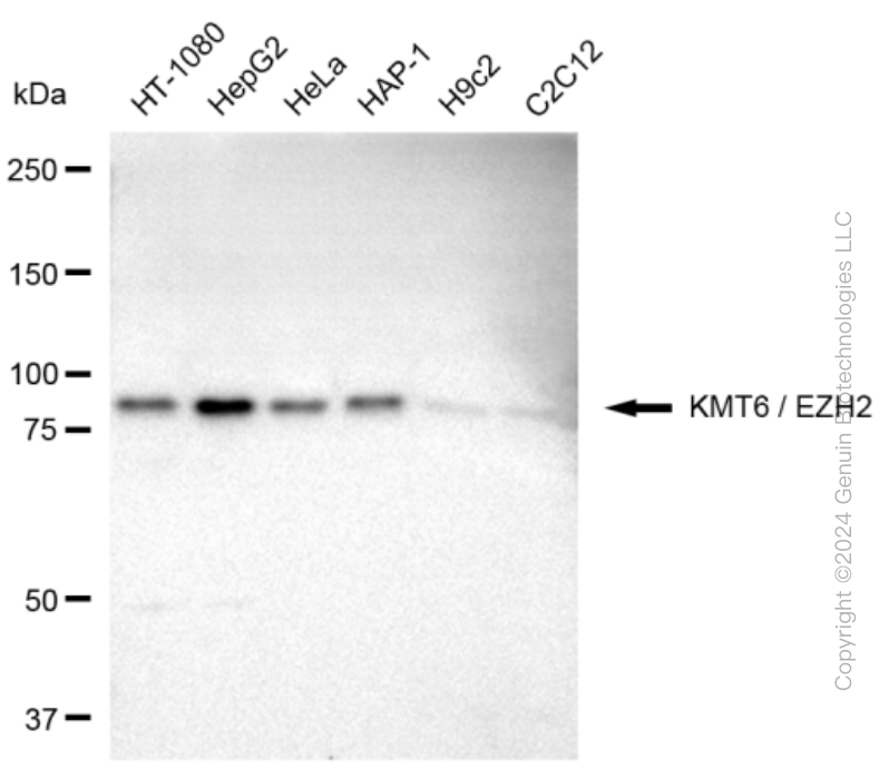 KD-Validated Anti-KMT6/EZH2 Rabbit Monoclonal Antibody ABG2399