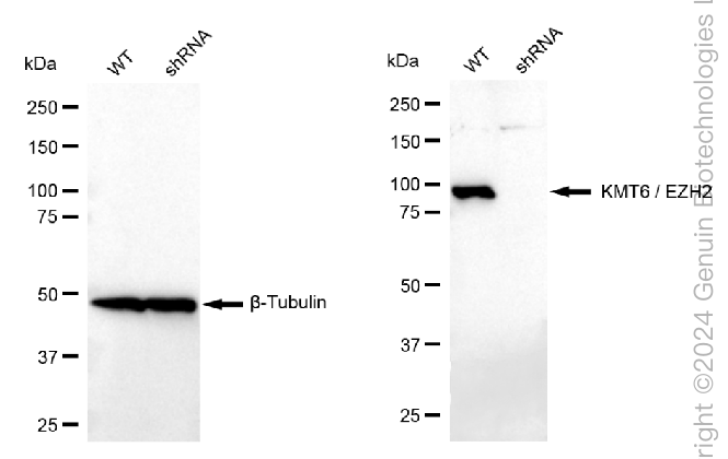 KD-Validated Anti-KMT6/EZH2 Rabbit Monoclonal Antibody ABG2399