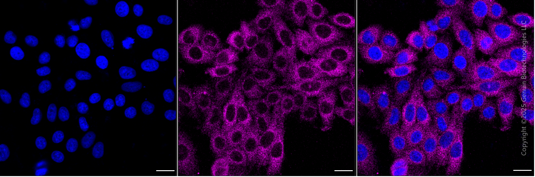 KO-Validated Anti-FERMT2 Mouse Monoclonal Antibody ABG2400