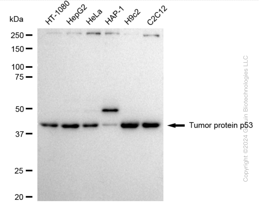 KO-Validated Anti-Tumor Protein P53 Rabbit Polyclonal Antibody ABG2404