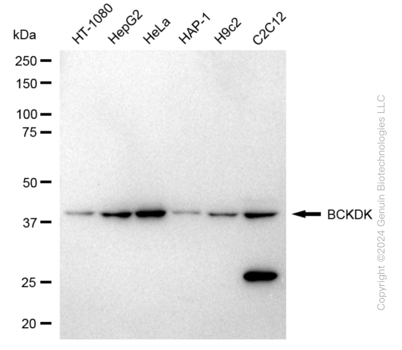KO-Validated Anti-BCKDK Rabbit Polyclonal Antibody ABG2405